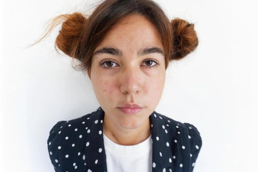 When Acne Treatment Needs to Go Deeper Than the Surface